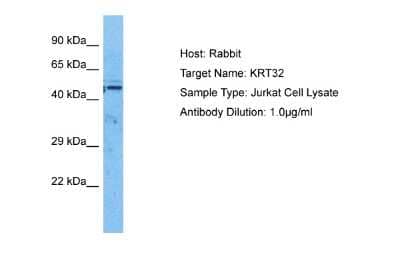 Western Blot KRTHA2 Antibody - BSA Free
