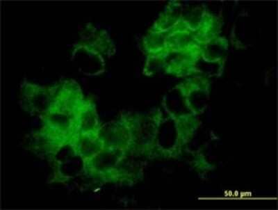 Immunocytochemistry/Immunofluorescence: KRTHA3B Antibody (4A6-A7) [H00003884-M01] - Analysis of monoclonal antibody to KRTHA3B on MCF-7 cell . Antibody concentration 10 ug/ml.