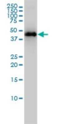 Western Blot: KRTHA3B Antibody (4A6-A7) [H00003884-M01] - KRTHA3B monoclonal antibody (M01), clone 4A6-A7 Analysis of KRTHA3B expression in MCF-7.