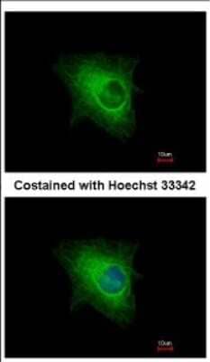 Immunocytochemistry/ Immunofluorescence KRTHA3B Antibody