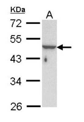 Western Blot: KRTHA3B Antibody [NBP1-31709] - Sample (30 ug of whole cell lysate) A: Hela 10% SDS PAGE; antibody diluted at 1:1000.