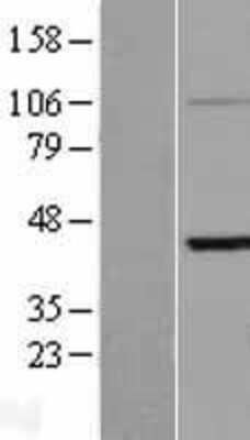 Western Blot KRTHA3B Overexpression Lysate