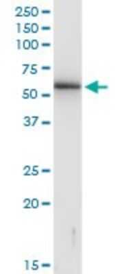 Western Blot: KRTHB3 Antibody [H00003889-B01P] - Analysis of KRT83 expression in HeLa.