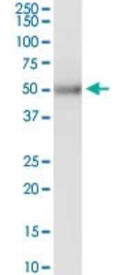 Western Blot: KRTHB3 Antibody [H00003889-D01P] - Analysis of KRT83 expression in human colon.