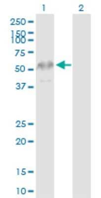 Western Blot: KRTHB3 Antibody [H00003889-D01P] - Analysis of KRT83 expression in transfected 293T cell line by KRT83 polyclonal antibody.Lane 1: KRT83 transfected lysate(54.20 KDa).Lane 2: Non-transfected lysate.