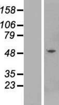 Western Blot: KRTHB3 Overexpression Lysate (Adult Normal) [NBP2-10817] Left-Empty vector transfected control cell lysate (HEK293 cell lysate); Right -Over-expression Lysate for KRTHB3.