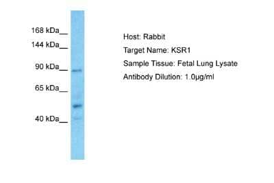 Western Blot: KSR1 Antibody [NBP2-85179] - Host: Rabbit. Target Name: KSR1. Sample Type: Fetal Lung lysates. Antibody Dilution: 1.0ug/ml
