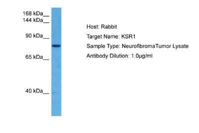 Western Blot: KSR1 Antibody [NBP2-85180] - Host: Rabbit. Target Name: KSR1. Sample Tissue: Human Neurofibroma Tumor lysates. Antibody Dilution: 1ug/ml