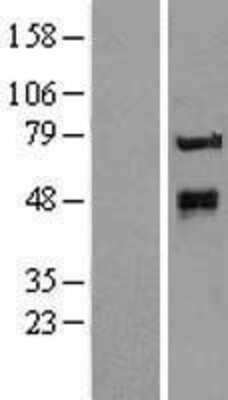 Western Blot: KTELC1 Overexpression Lysate (Adult Normal) [NBL1-12413] Left-Empty vector transfected control cell lysate (HEK293 cell lysate); Right -Over-expression Lysate for KTELC1.