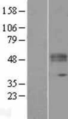 Western Blot: KTELC1 Overexpression Lysate (Adult Normal) [NBL1-12414] Left-Empty vector transfected control cell lysate (HEK293 cell lysate); Right -Over-expression Lysate for KTELC1.