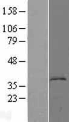 Western Blot: KYNU Overexpression Lysate (Adult Normal) [NBL1-12416] Left-Empty vector transfected control cell lysate (HEK293 cell lysate); Right -Over-expression Lysate for KYNU.