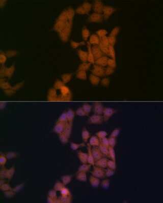 Immunocytochemistry/Immunofluorescence: Kaiso Antibody (10O4V2) [NBP3-16272] - Immunofluorescence analysis of HeLa cells using Kaiso Rabbit mAb (NBP3-16272) at dilution of 1:100 (40x lens). Blue: DAPI for nuclear staining.