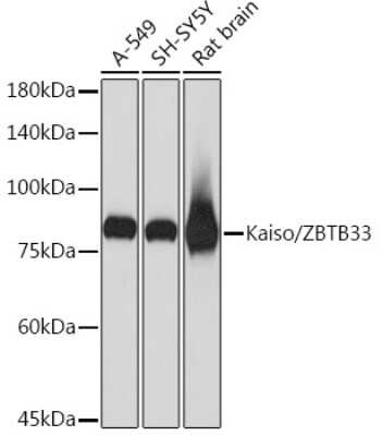 Western Blot: Kaiso Antibody (10O4V2) [NBP3-16272] - Western blot analysis of extracts of various cell lines, using Kaiso Rabbit mAb (NBP3-16272) at 1:1000 dilution. Secondary antibody: HRP Goat Anti-Rabbit IgG (H+L) at 1:10000 dilution. Lysates/proteins: 25ug per lane. Blocking buffer: 3% nonfat dry milk in TBST. Detection: ECL Basic Kit. Exposure time: 1s.