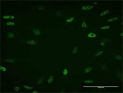 Immunocytochemistry/Immunofluorescence: Kaiso Antibody (3A8) [H00010009-M02] - Analysis of monoclonal antibody to ZBTB33 on HeLa cell . Antibody concentration 10 ug/ml.