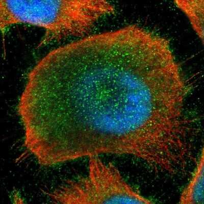 Immunocytochemistry/Immunofluorescence: Kaiso Antibody [NBP1-87865] - Immunofluorescent staining of human cell line U-251 MG shows localization to nucleoplasm, plasma membrane & cytosol.