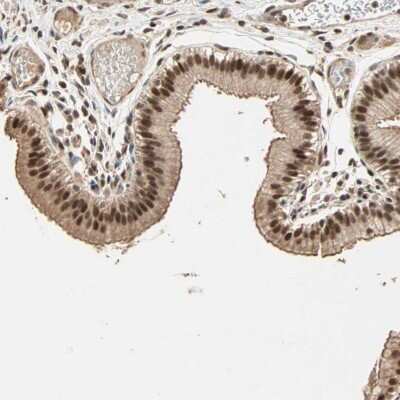 Immunohistochemistry-Paraffin: Kaiso Antibody [NBP1-87865] - Staining of human gallbladder shows strong nuclear positivity in glandular cells.