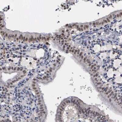 Immunohistochemistry-Paraffin Kaiso Antibody