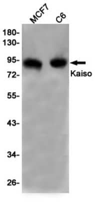 Western Blot: Kaiso Antibody (S05-5J5) [NBP3-19669] - Western blot detection of Kaiso in MCF7, C6 cell lysates using NBP3-19669 (1:1000 diluted). Predicted band size: 75KDa. Observed band size: 90KDa.