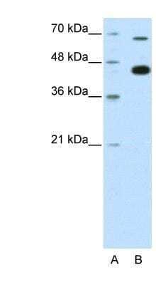 Western Blot: Kaiso Antibody [NBP1-80316] - HepG2 cell lysate, concentration 0.2-1 ug/ml.