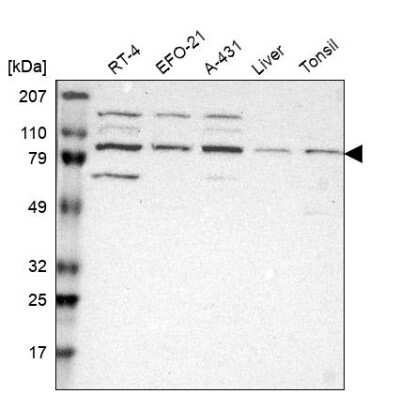 Western Blot Kaiso Antibody