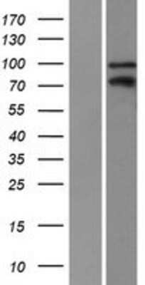 Western Blot: Kaiso Overexpression Lysate (Adult Normal) [NBP2-10398] Left-Empty vector transfected control cell lysate (HEK293 cell lysate); Right -Over-expression Lysate for Kaiso.