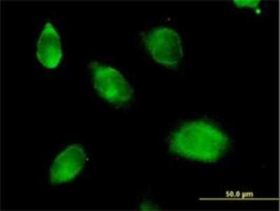 Immunocytochemistry/Immunofluorescence: Kallikrein 10 Antibody [H00005655-B01P] - Immunofluorescence of purified MaxPab antibody to KLK10 on HeLa cell. [antibody concentration 10 ug/ml]