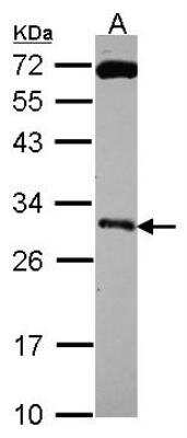 Western Blot: Kallikrein 10 Antibody [NBP2-19971] - Kallikrein 10  Antibody Sample (30 ug of whole cell lysate) A: Hep G2 12% SDS PAGE gel, diluted at 1:500.