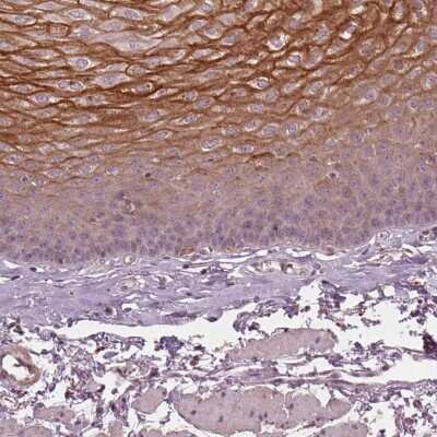Immunohistochemistry-Paraffin: Kallikrein 13 Antibody [NBP2-49358] - Staining of human esophagus shows high expression.