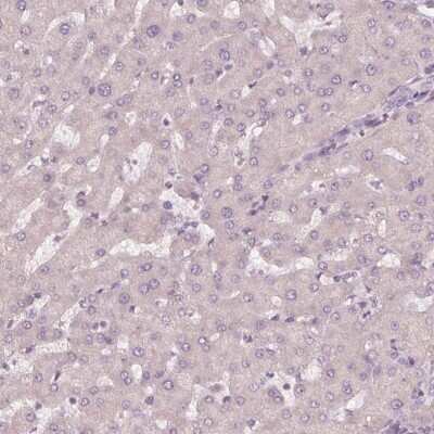 Immunohistochemistry-Paraffin: Kallikrein 13 Antibody [NBP2-49358] - Staining of human liver shows low expression as expected.