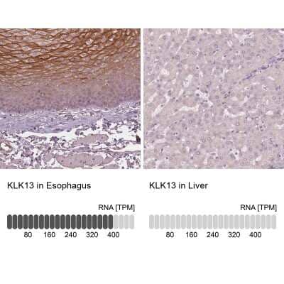 Immunohistochemistry-Paraffin: Kallikrein 13 Antibody [NBP2-49358] - Staining in human esophagus and liver tissues using anti-KLK13 antibody. Corresponding KLK13 RNA-seq data are presented for the same tissues.
