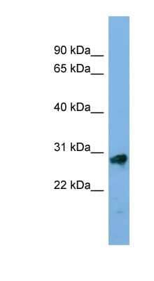 Western Blot: Kallikrein 13 Antibody [NBP1-56348] - PANC1 cell lysate, concentration 0.2-1 ug/ml.