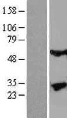 Western Blot: Kallikrein 13 Overexpression Lysate (Adult Normal) [NBL1-12348] Left-Empty vector transfected control cell lysate (HEK293 cell lysate); Right -Over-expression Lysate for Kallikrein 13.