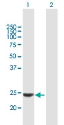 Western Blot: Kallikrein 14 Antibody [H00043847-B01P] - Analysis of KLK14 expression in transfected 293T cell line by KLK14 polyclonal antibody.  Lane 1: KLK14 transfected lysate(27.61 KDa). Lane 2: Non-transfected lysate.