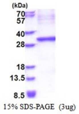 SDS-Page: Kallikrein 15 Recombinant Protein [NBP2-51573] - 15% SDS Page (3 ug)