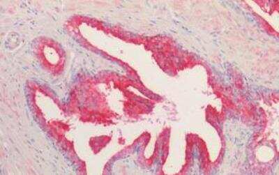 Immunohistochemistry-Paraffin: Kallikrein 2 Antibody [NBP1-06046] - Staining of paraffin embedded Human Prostate. Steamed antigen retrieval with citrate buffer pH 6, AP-staining.