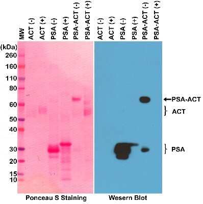 Western Blot: Kallikrein 3/PSA Antibody (RM323) [NBP2-77416] - Western Blot of PSA (purified from human seminal fluid), ACT (alpha 1-antichymotrypsin, from human plasma), and PSA-ACT complex, under non-reduced (-) or reduced (+) conditions, using NBP2-77416.