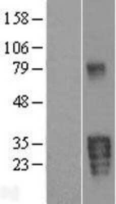 Western Blot Kallikrein 5 Overexpression Lysate