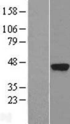 Western Blot Kallikrein 5 Overexpression Lysate