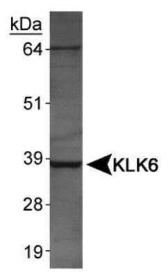 Western Blot: Kallikrein 6/Neurosin Antibody [NBP1-06497] - Human salivary lysates.