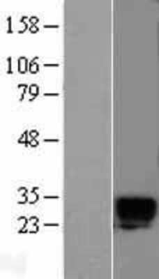 Western Blot: Kallikrein 6 Overexpression Lysate (Adult Normal) [NBL1-12354] Left-Empty vector transfected control cell lysate (HEK293 cell lysate); Right -Over-expression Lysate for Kallikrein 6.