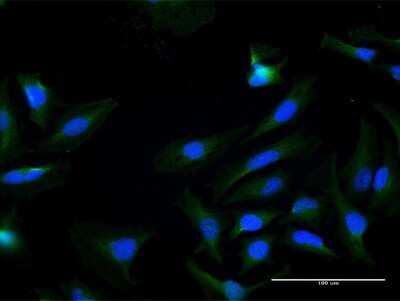 Immunocytochemistry/Immunofluorescence: Kallikrein 7 Antibody [H00005650-B01P] - Analysis of purified antibody to KLK7 on HeLa cell. (antibody concentration 10 ug/ml)