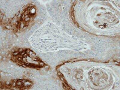 Immunohistochemistry-Paraffin: Kallikrein 7 Antibody [NBP1-31428] -  Cal27 xenograft, using KLK7 antibody at 1:100 dilution. Antigen Retrieval: Trilogy™ (EDTA based, pH 8.0) buffer, 15min. 