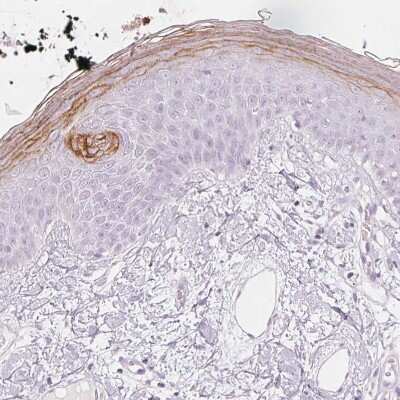 Immunohistochemistry-Paraffin: Kallikrein 7 Antibody [NBP2-38950] - Staining of human skin shows weak to moderate cytoplasmic positivity in keratinocytes.