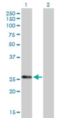 Western Blot: Kallikrein 7 Antibody [H00005650-B02P] - Analysis of KLK7 expression in transfected 293T cell line by KLK7 polyclonal antibody.  Lane 1: KLK7 transfected lysate(27.83 KDa). Lane 2: Non-transfected lysate.
