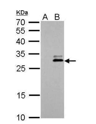 Western Blot: Kallikrein 7 Antibody [NBP1-32999] - A. 30 ug 293T whole cell lysate/extract B. 30 ug whole cell lysate/extract of human KLK7-transfected 293T cells 12 % SDS-PAGE KLK7 antibody dilution: 1:5000