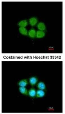 Immunocytochemistry/ Immunofluorescence Kanadaptin Antibody