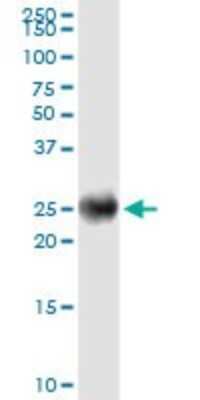 Western Blot: Kappa Light Chain Antibody (1F6) [H00003514-M06] - Analysis of IGKC expression in human kidney.