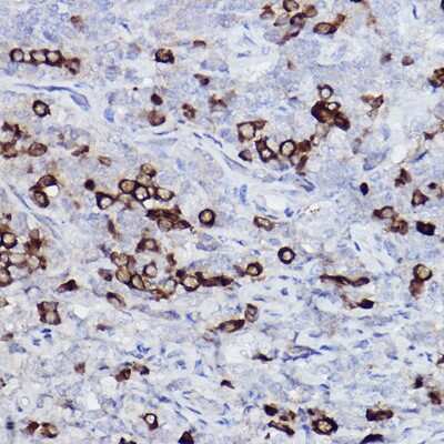 Immunohistochemistry-Paraffin: Kappa Light Chain Antibody (8O7Q9) [NBP3-15596] - Immunohistochemistry of paraffin-embedded human tonsil using Kappa Light Chain Rabbit mAb (NBP3-15596) at dilution of 1:100 (40x lens).Perform high pressure antigen retrieval with 10 mM citrate buffer pH 6.0 before commencing with IHC staining protocol.