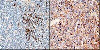 Immunohistochemistry-Paraffin: Kappa Light Chain Antibody (A21-Y) [NBP1-30139] - - human tonsil tissue and bone plasmocytoma stained with anti-Kappa Light Chain Antibody