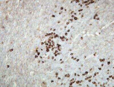 Immunohistochemistry-Paraffin: Kappa Light Chain Antibody (A21-Y) [NBP1-30139] - Expression of the Kappa Light Chain immunoglobulin in the plasma cells of the palatine tonsil. Formalin fixed, paraffin embedded human tissues (4 um sections) stained with anti - Human Kappa light chain (DB 037) monospecific clonal antibody.
